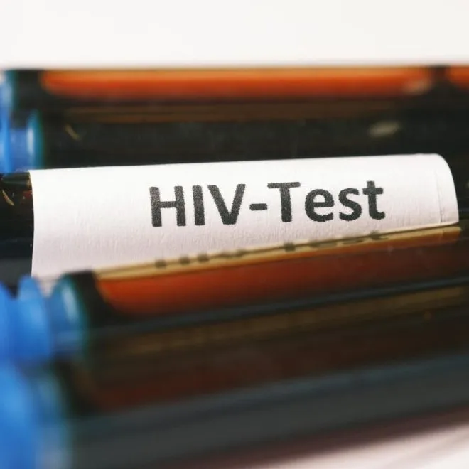 Norveç’te Tarihi Başarı: HIV’den Kurtulan 10. Hasta
